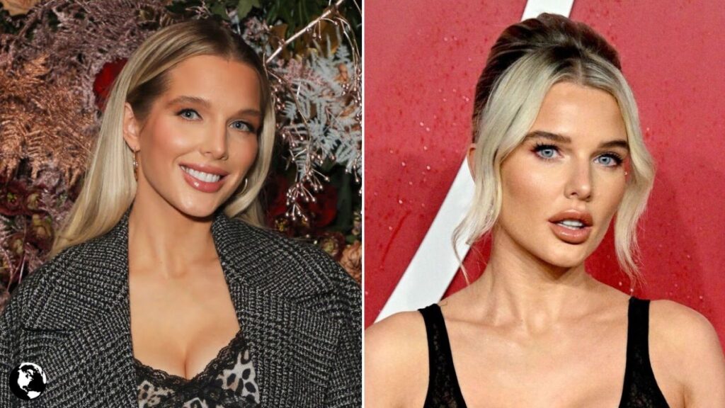 Helen Flanagan Net Worth 2025: Inside the TV Star’s Fortune, Career Earnings & Financial Comeback helen flanagan net worth