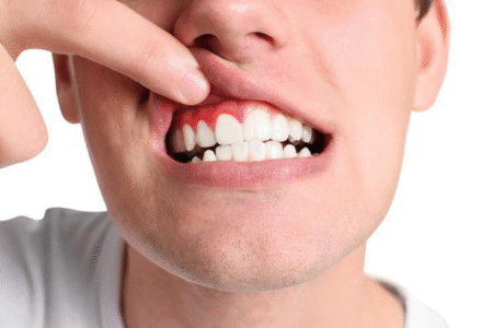 More Than a Smile: How Your Mouth Affects Your Entire Body